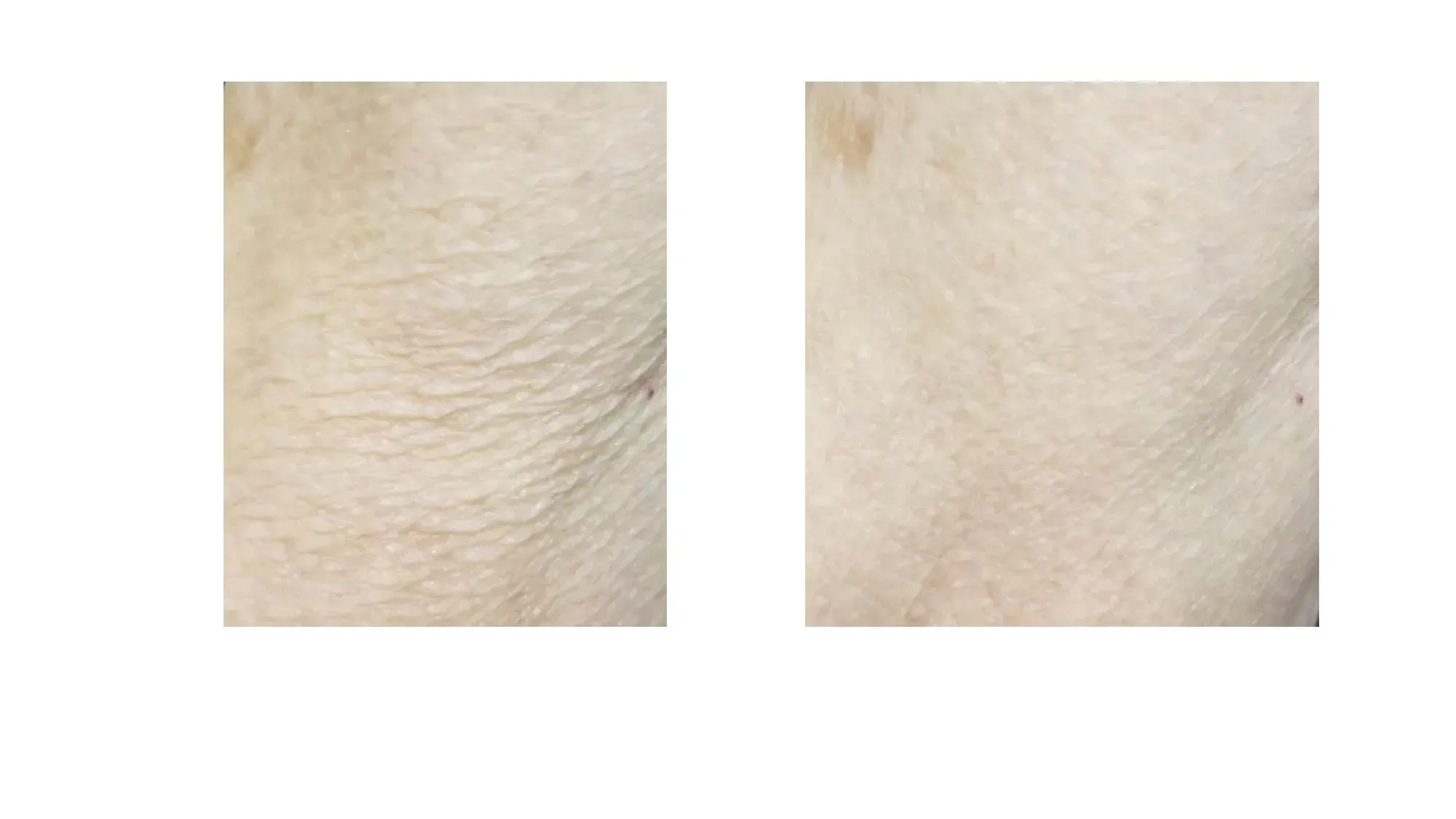 Before and after images of using CrepeSilk.